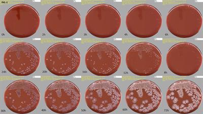 Total Laboratory Automation for Rapid Detection and Identification of Microorganisms and Their Antimicrobial Resistance Profiles